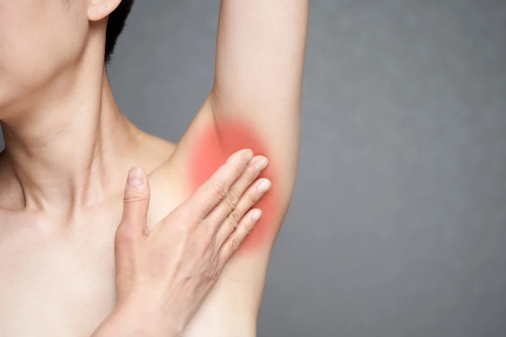 irritación depilación